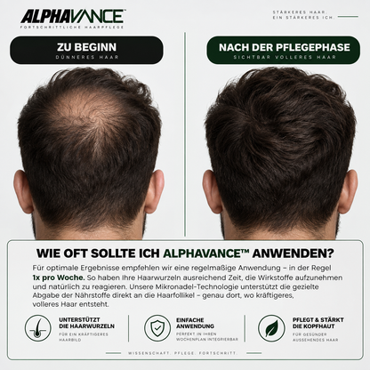 AlphaVance™ - System zur Haarwiederherstellung