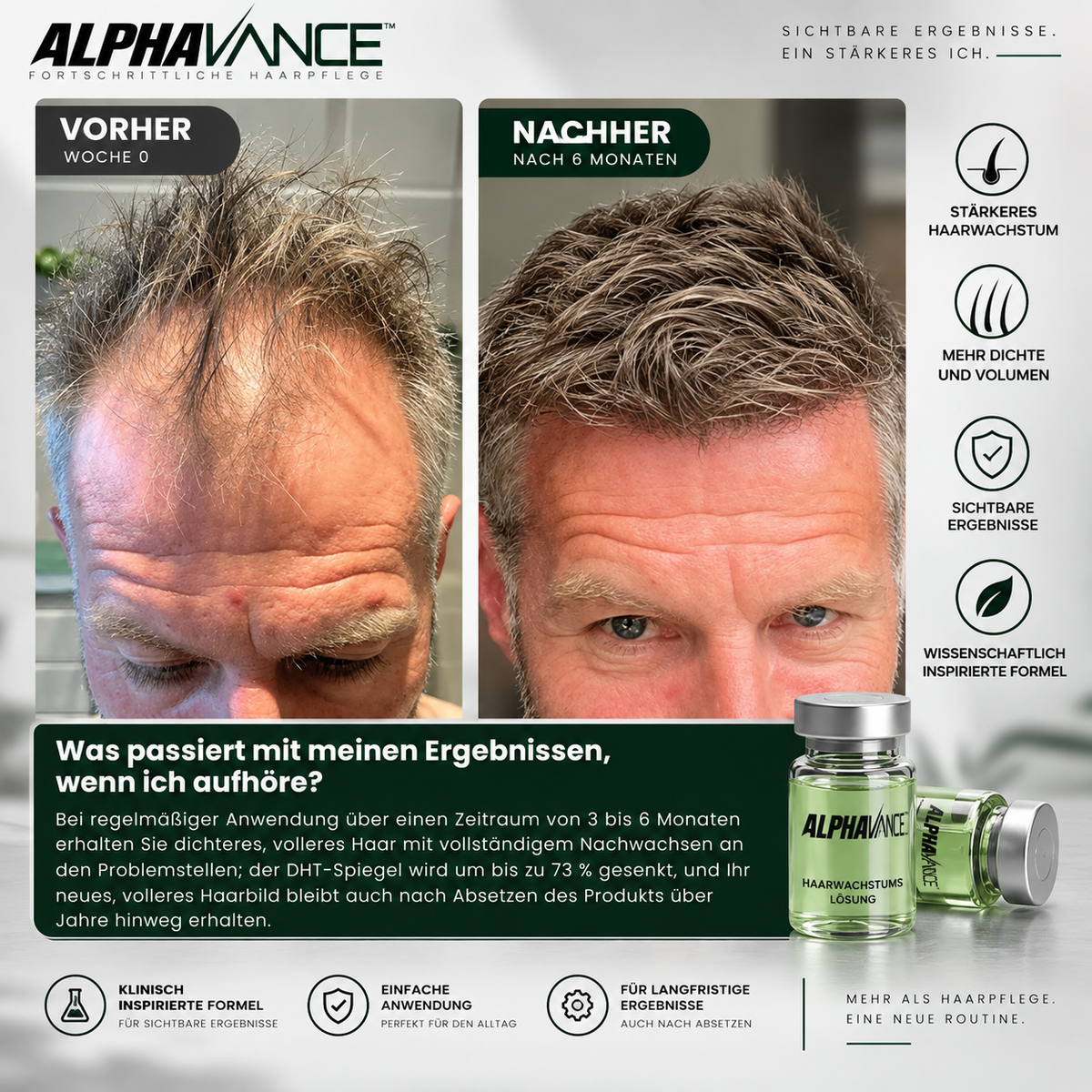 AlphaVance™ - System zur Haarwiederherstellung