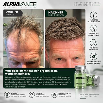 AlphaVance™ - System zur Haarwiederherstellung